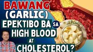 Bawang (Garlic): Epektibo Ba sa High Blood at Cholesterol?  - By Doc Willie Ong