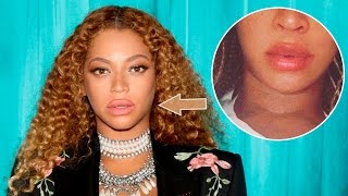 Beyonce Se Operó Los Labios Estando Embarazada De Gemelos?