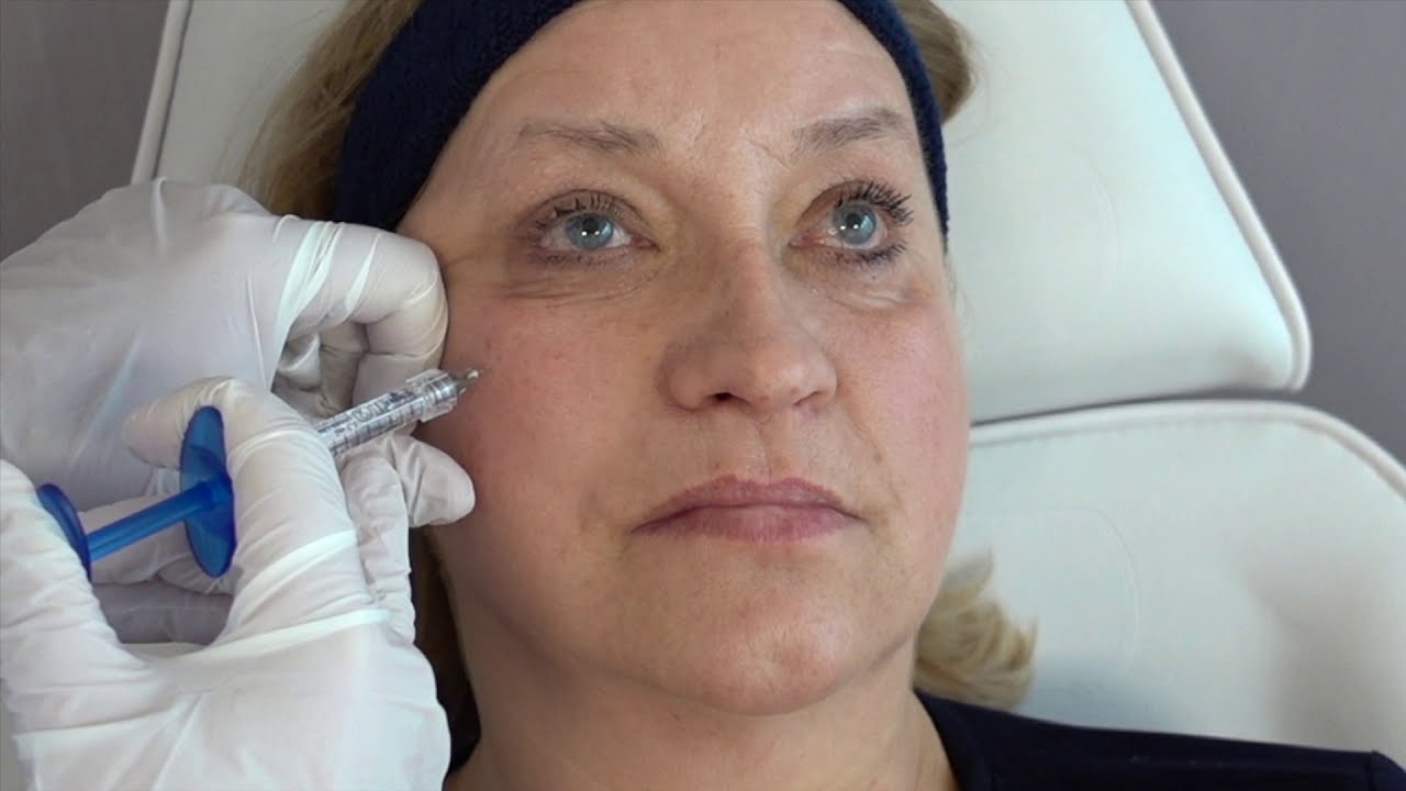 Aliaxin Superior Volume by Dr Gabriel Siquier