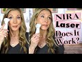 Nira precision laser review  before  after 150 days