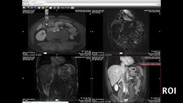 Sneak preview: Zero footprint HTML 5 DICOM PACS Viewer