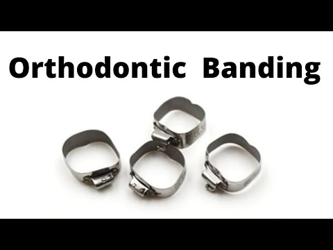 Orthodontic Band & Separators Selection and Placement, Molar preformed bands vs tubes || Lecture