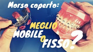 Mobile o fisso per il morso coperto?