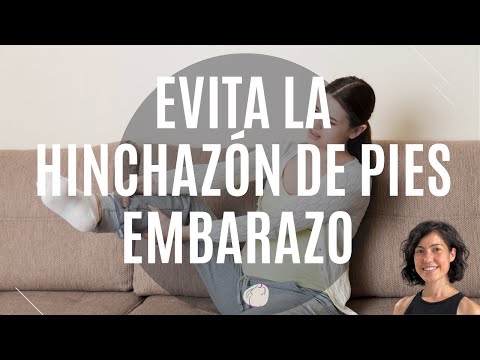 Video: Cómo reducir el edema durante el embarazo: 14 pasos (con imágenes)