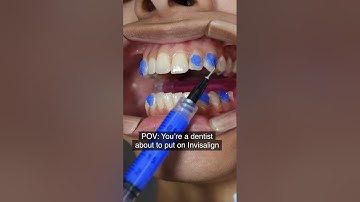 Invisalign attachments