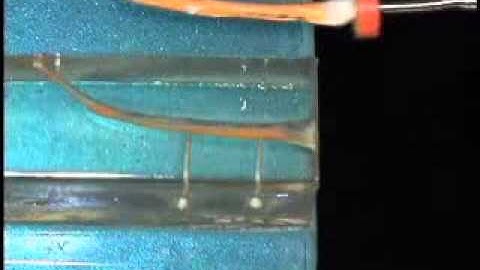 Elements Obturation Unit