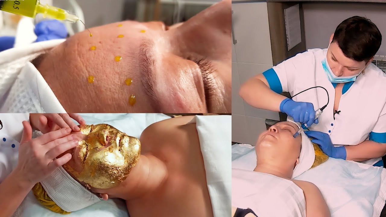 Микронидлинг с Dermapen & Пилинг Биорепил & Золотая маска. Профессиональный уход за зрелой кожей