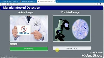Malaria infected detection deep learning project on flask.