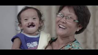 Operation Smile Bacolod 2018