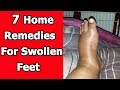 7 Home Remedies For Swollen Feet That Work