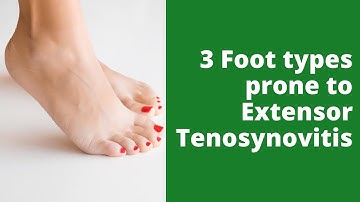 3 Foot types prone to Extensor Tenosynovitis