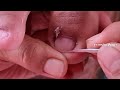 Very small and short nails/A lot of ingrown and cuticle(Part2) | Beauty&#39;s Skills