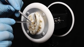 ASMR 3Dio Ear Peeling, Brushing Cleaning Latex Gloves  What Has Happened to Your Ears? (No talking)