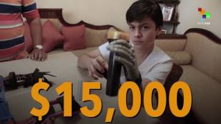 The Bolivian Teen Who made his Own Prosthetic Hand