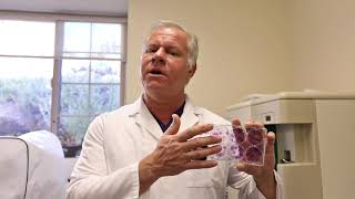 The More You Know - The Science Behind Centeno Schultz- Precise Stem Cell Dosing