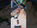 injection vlog injection #ytshorts #lifeisbutadream #injection #doctor
