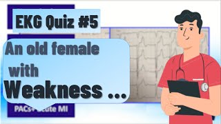 ECG quiz | An old female with weakness | ECG case presentation