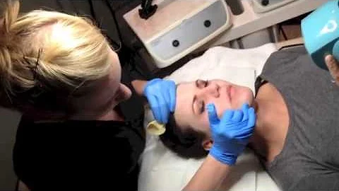 3-Step Stimulation Peel