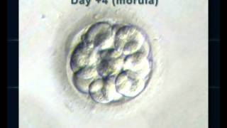 Les différentes étapes du développement de l'embryon en FIV