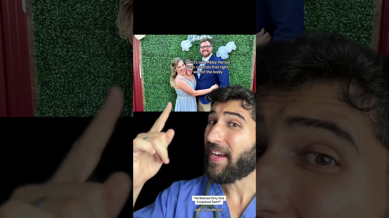  He Married Only One Conjoined Twin Questions