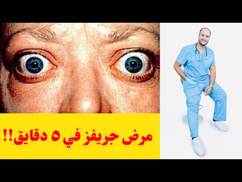 مرض جريفز و نشاط الغدة الدرقية الاعراض و الاسباب