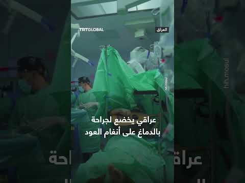 جراحة دماغ لمريض عراقي على أنغام العود