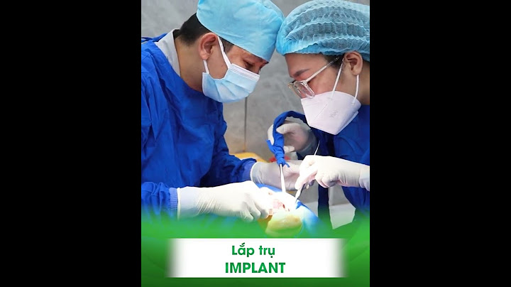 So sánh việc làm mô chụp và cấy implant