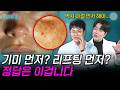 기미 먼저? 리프팅 먼저? 정답은 이겁니다ㅣ닥터미담