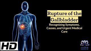 Ruptured Gallbladder: Emergency Signs, Causes, and Lifesaving Tips