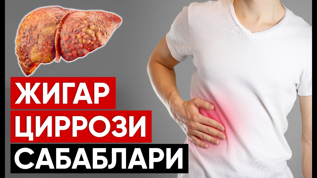 JIGAR SIRROZI SABABLARI VA BELGILARI