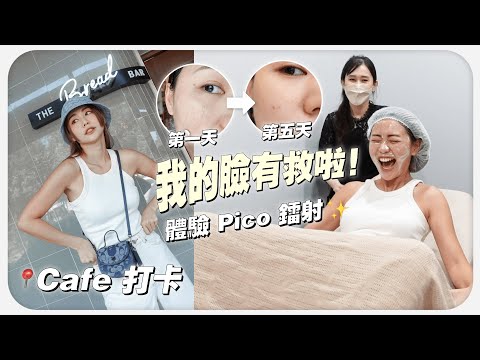 麵包控很喜歡的 Cafe 🥐 我的黑斑有救啦! 🤩 Pico 镭射初體驗 | MAYHO【 美好的一天 】