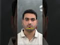 Hair Transplant Mein Achhe Result Ka Pehla Step – Sahi Clinic