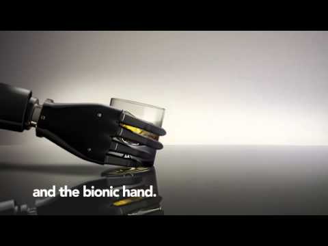 Scottish Development International - Bionic Hand