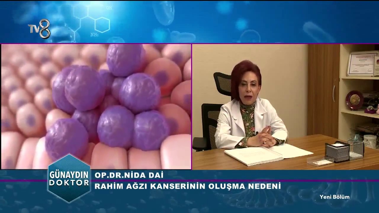 Rahim ağzı kanseri: semptomlar, nedenleri, tedavisi Rahim ağzı kanseri: semptomlar, nedenleri, tedavisi