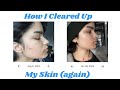 How i cleared up my skin again