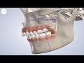 TMJ Treatment in Modesto CA | Greater Modesto Dental Implant & Oral Surgery Center