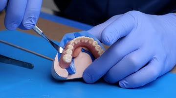 Section C: The Pickup | Chapter 2: The Pickup (Remove the Denture) - Smart Denture Conversions Train