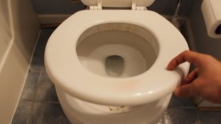 Angelo's Diarrhea Filled Toilet