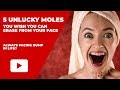 Unlucky Moles Position On Your Face | Facial Mole Reading Physiognomy