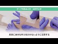 スキンテアを予防するためのテープの貼り方・はがし方