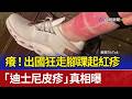癢！出國狂走腳踝起紅疹 「迪士尼皮疹」真相曝 kDkxbEtZIAE