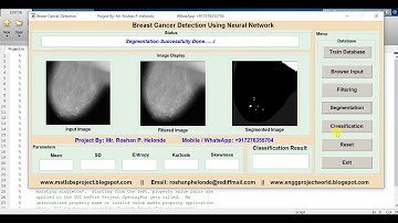 Matlab Code for Breast Cancer Detection Using Neural Network
