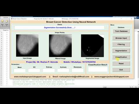 Matlab Code for Breast Cancer Detection Using Neural Network
