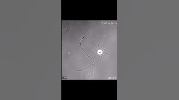 A lone #brain #cell reaching out for connections #science