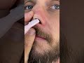 How to trim nose hair safe and easy