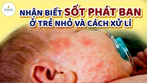 Sốt phát ban biểu hiện như thế nào