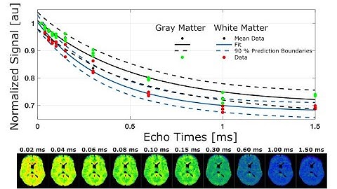 Myelin Imaging Using 3D Dual-echo Ultra-short Echo (20 us) Time MRI with Rosette k-Space Pattern