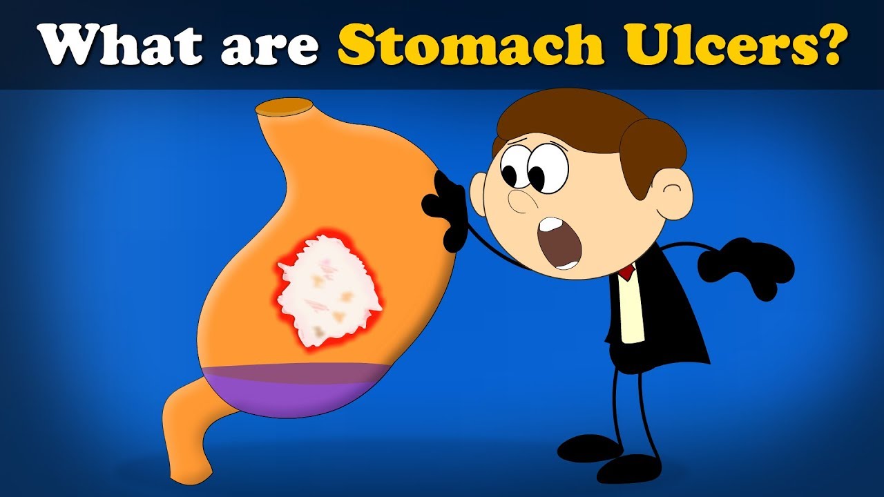 What Are Stomach Ulcers? + More Videos | #Aumsum #Kids #Science #Education #Children