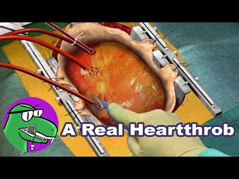 Virtual Surgeon: Open Heart (1997) Stream VOD (07/23/2022):