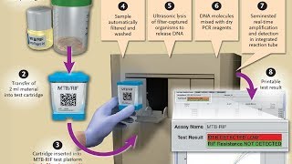 An Overview of TB Laboratory Strengthening